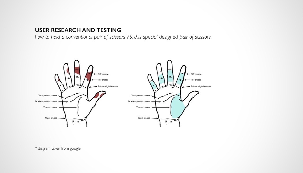 carpal_tunnel_scissors_03